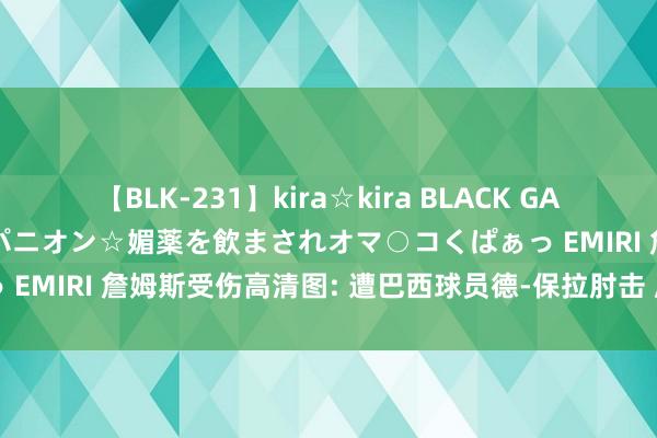 【BLK-231】kira☆kira BLACK GAL 黒ギャル中出し温泉コンパニオン☆媚薬を飲まされオマ○コくぱぁっ EMIRI 詹姆斯受伤高清图: 遭巴西球员德-保拉肘击 眉骨开裂渗血